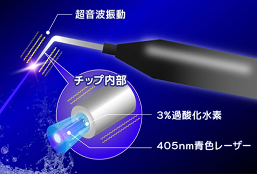 ブルーラジカル治療